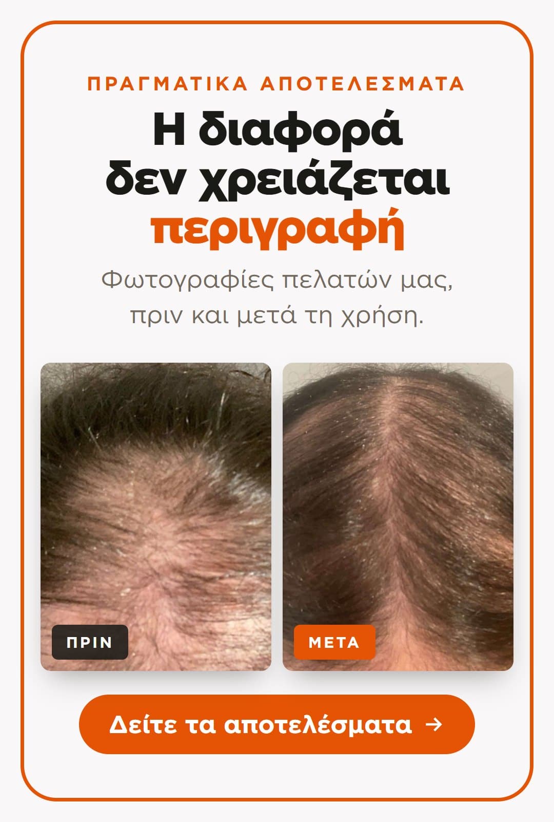 Πριν και μετά — αποτελέσματα πελατών Exesio