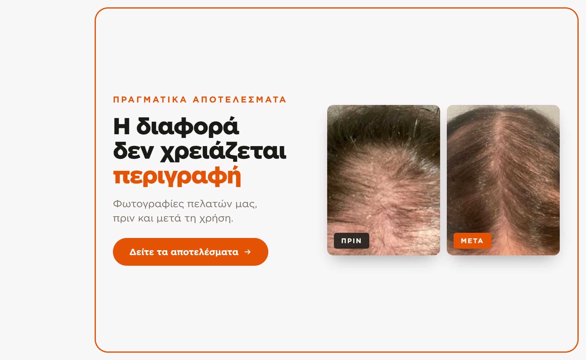 Πριν και μετά — αποτελέσματα πελατών Exesio